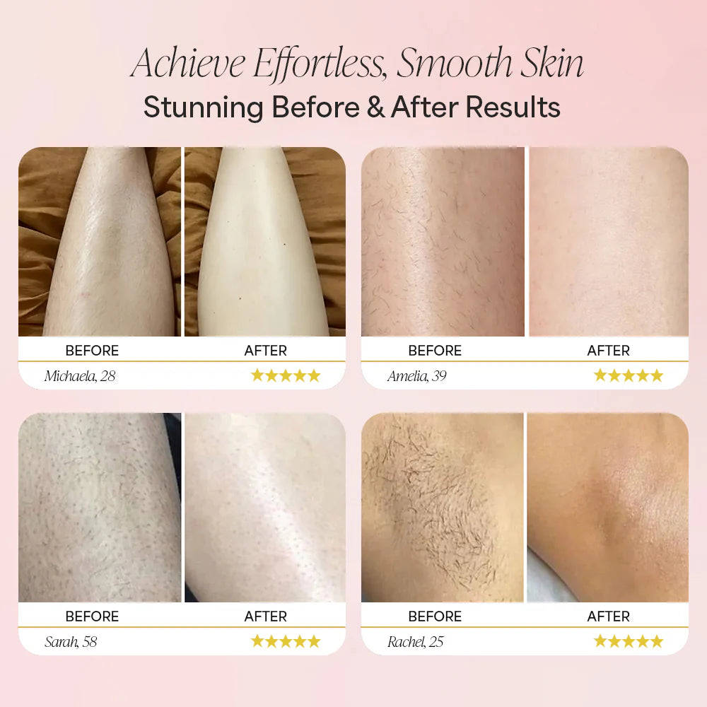 ALLTO Pro™ Trimmer