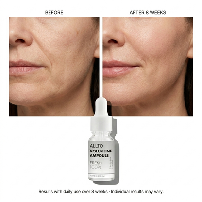 Fuller, Plumper-Looking Skin — Without the Needles.